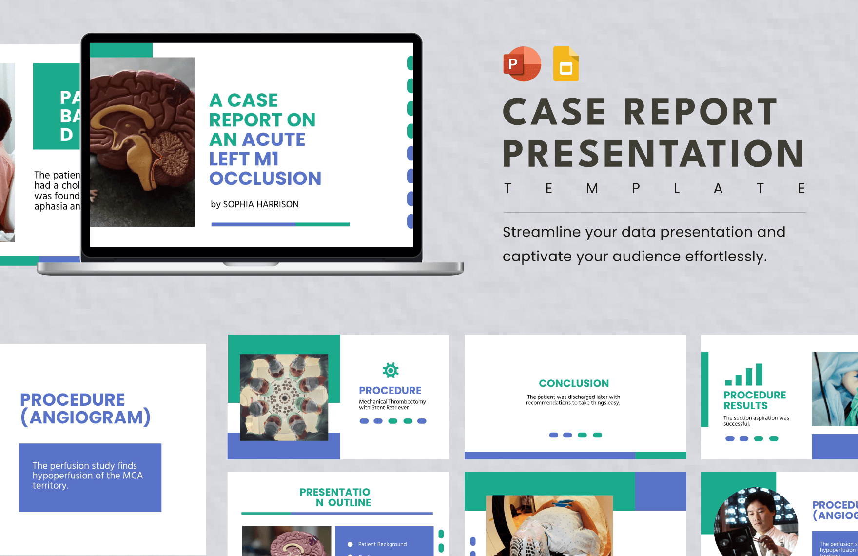 Case Report Presentation Template