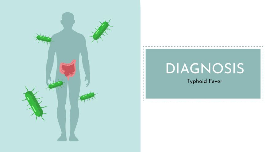 Free Typhoid Clinical Case Report Presentation Template to Edit Online