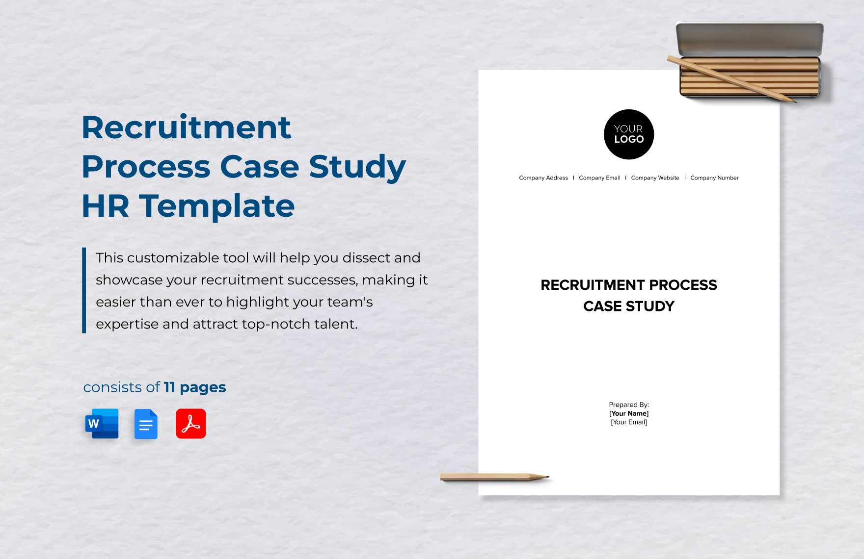 Recruitment Process Case Study HR Template in Word, Google Docs, PDF