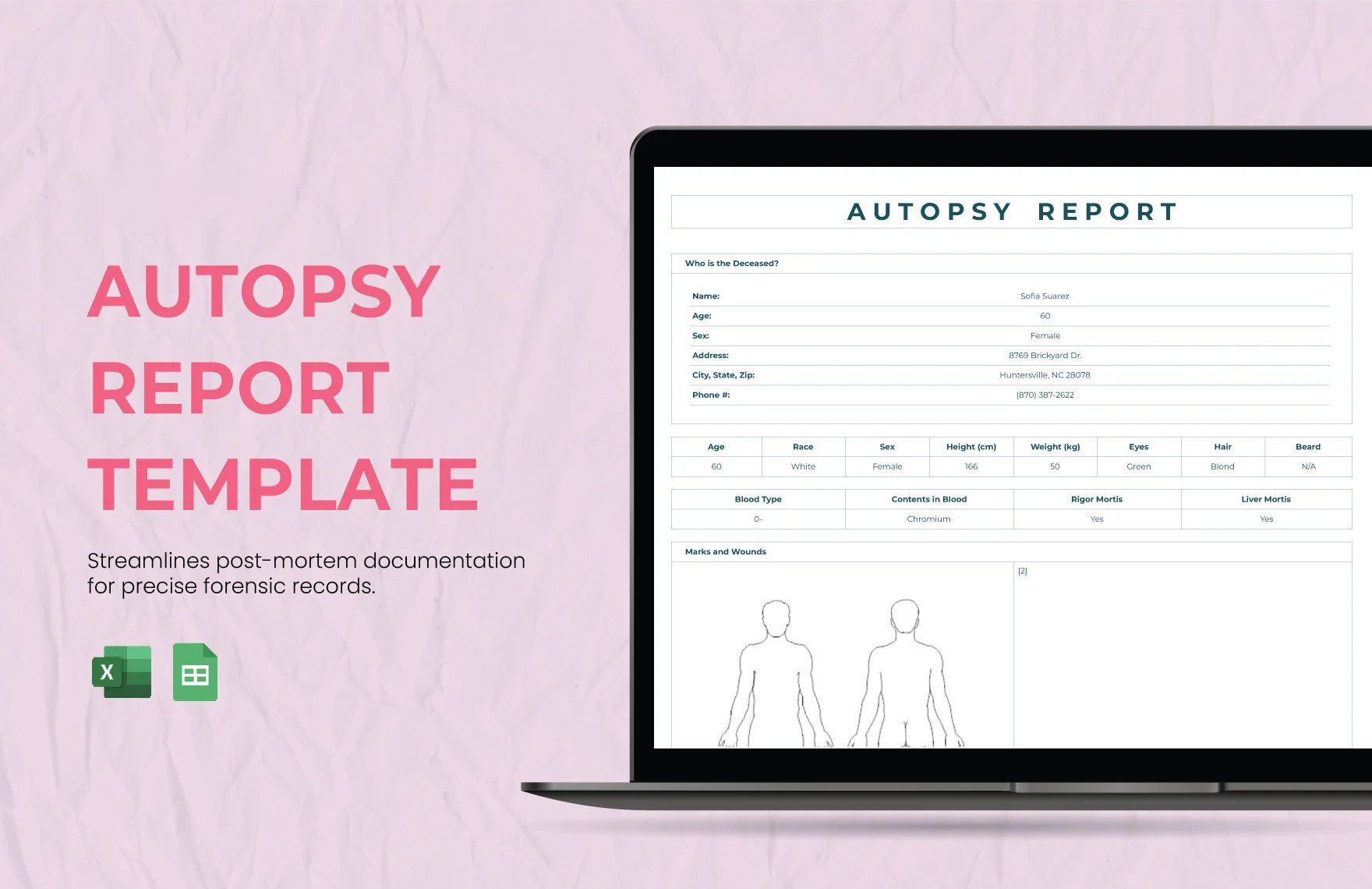 Autopsy Report Template in Excel, Google Sheets