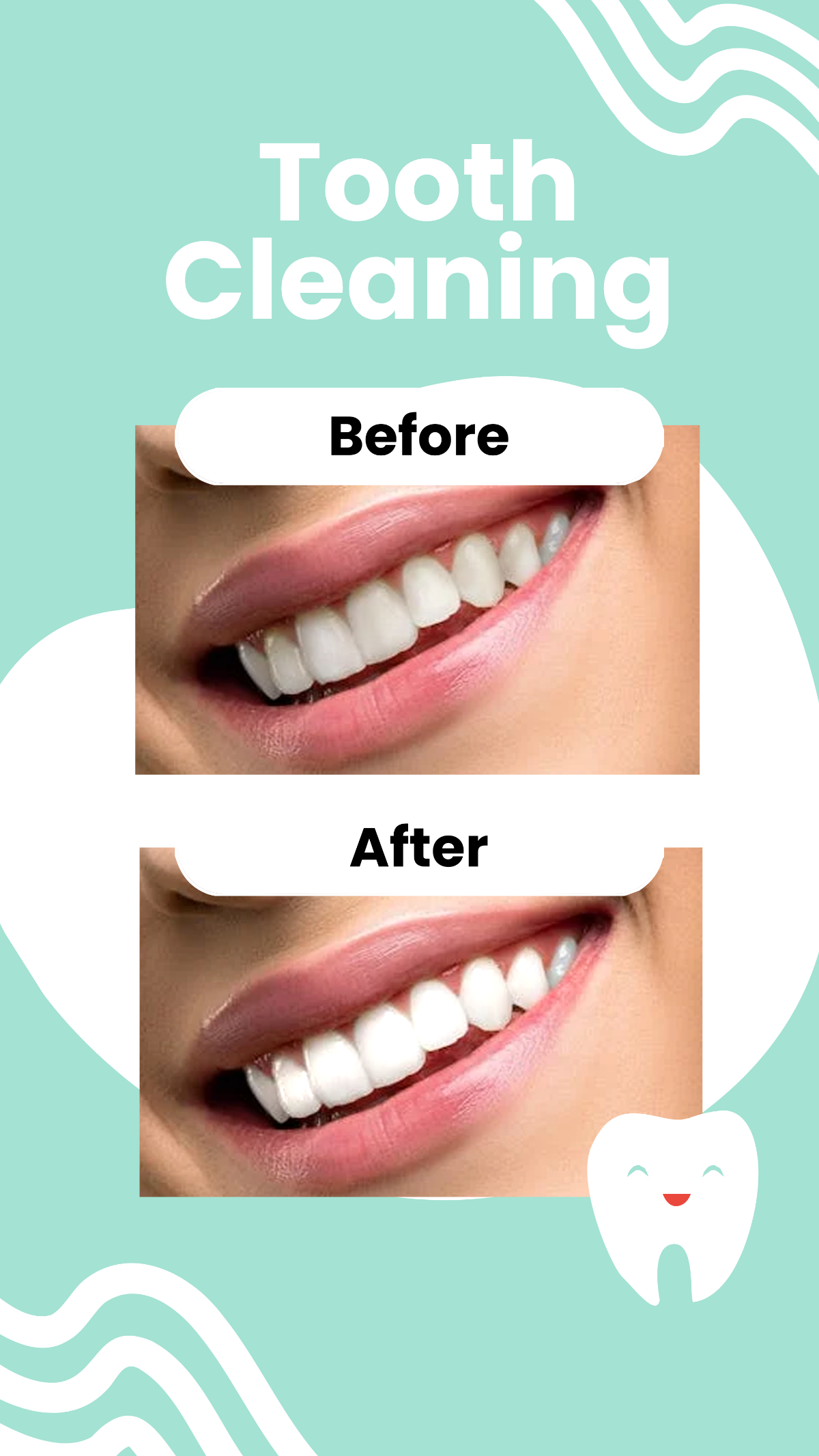 Before and After Tooth Cleaning Facebook Post