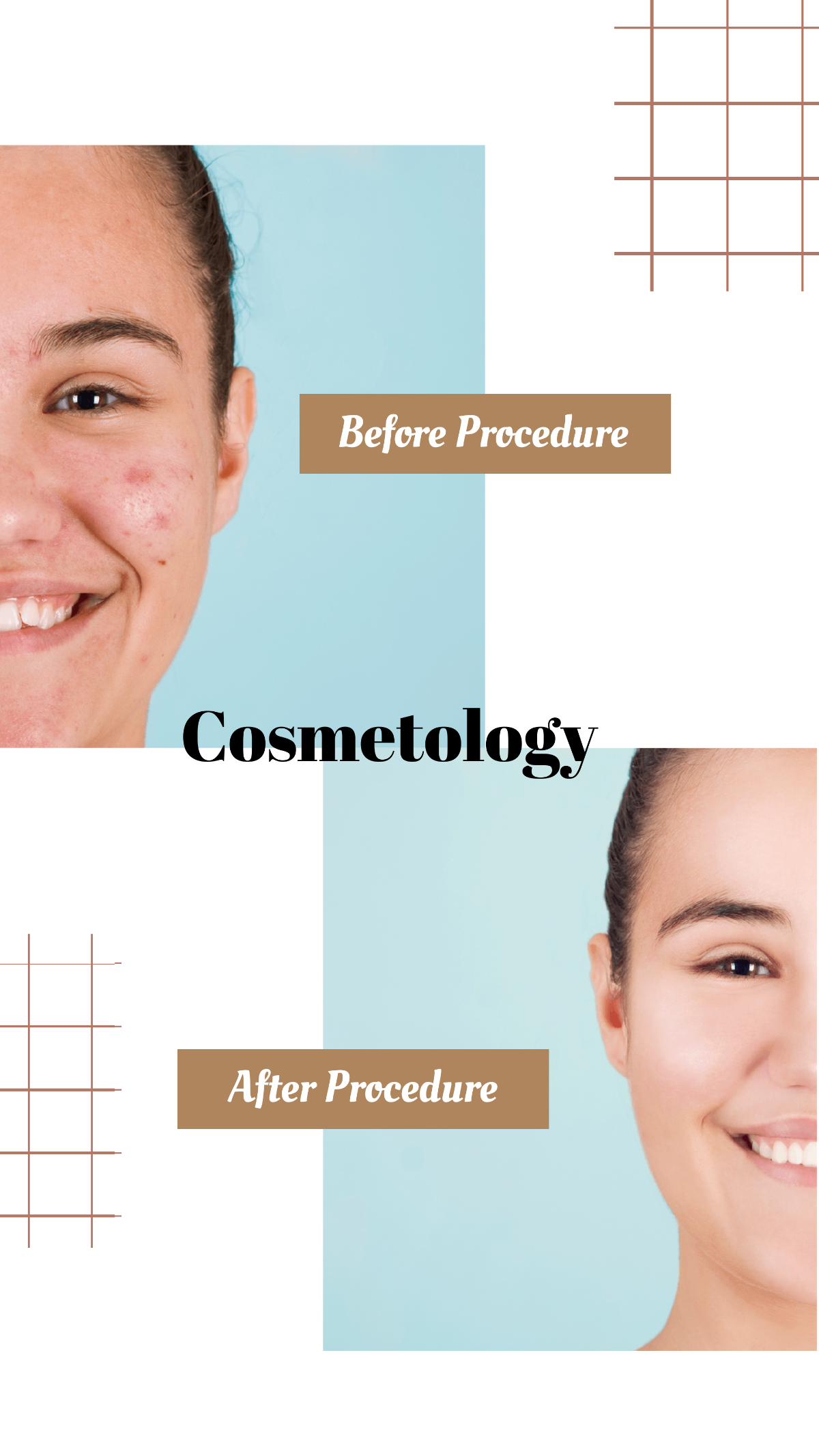 Cosmetology Before and After Instagram Post Template