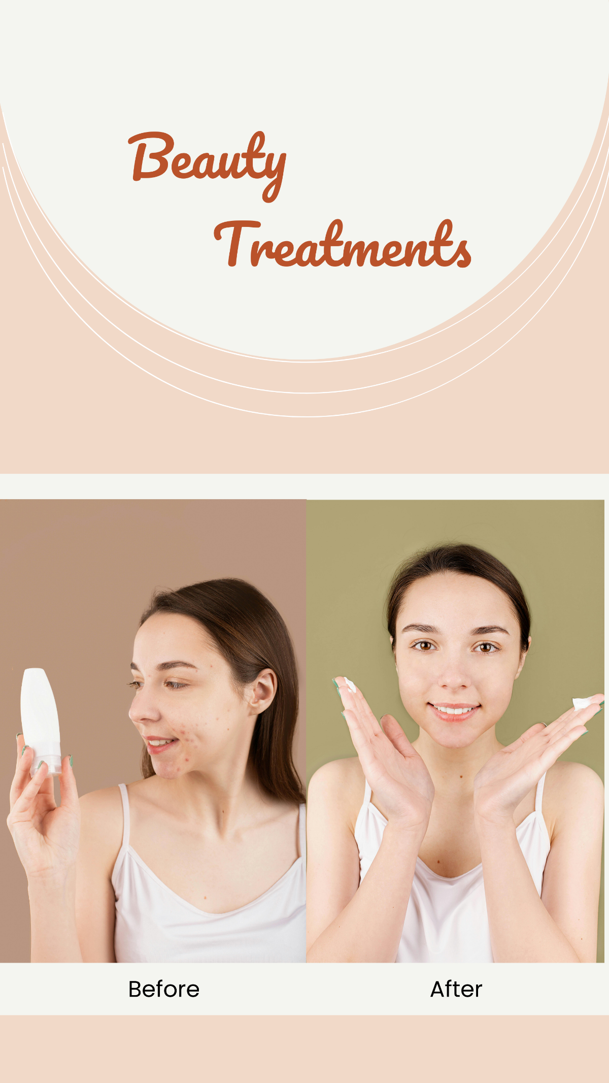 Beauty Treatments Before and After Story