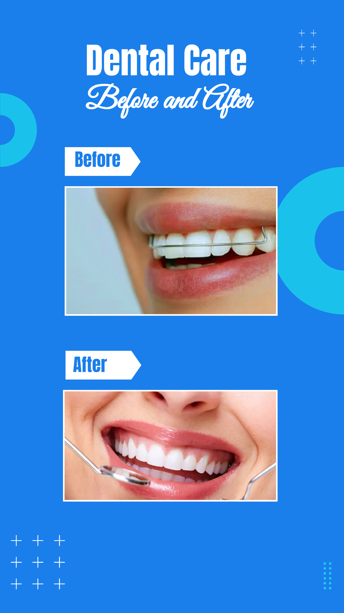 Free Dental Care Before and After Instagram Story