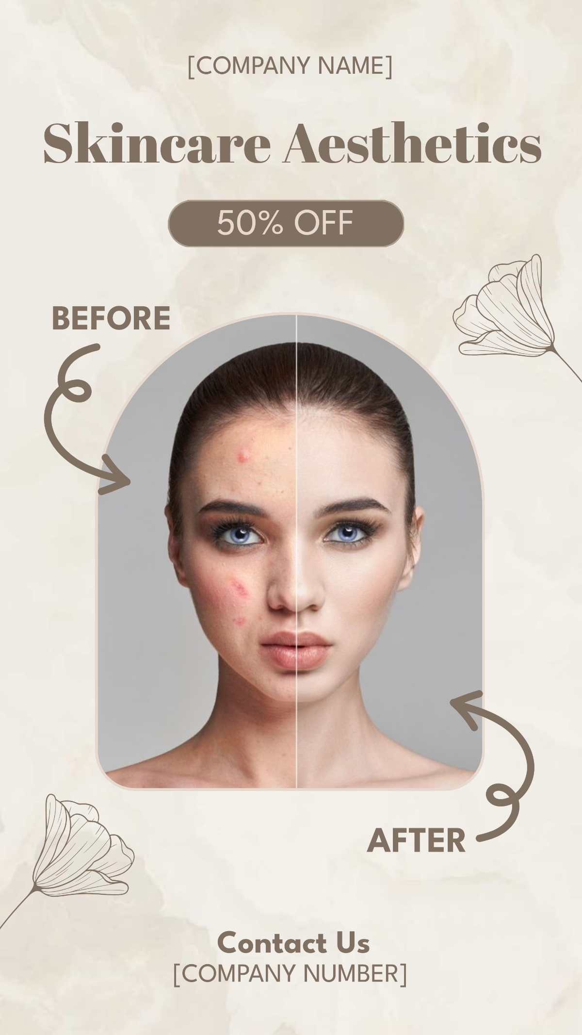 Skincare Before and After Promotion Instagram Story