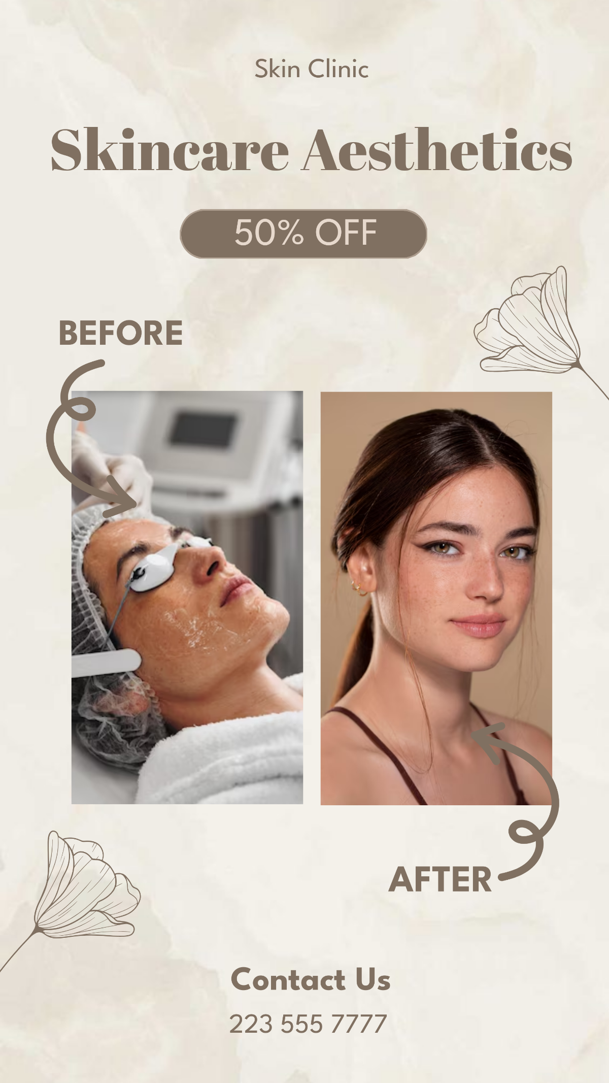 Skincare Before and After Promotion Instagram Story - Edit Online & Download