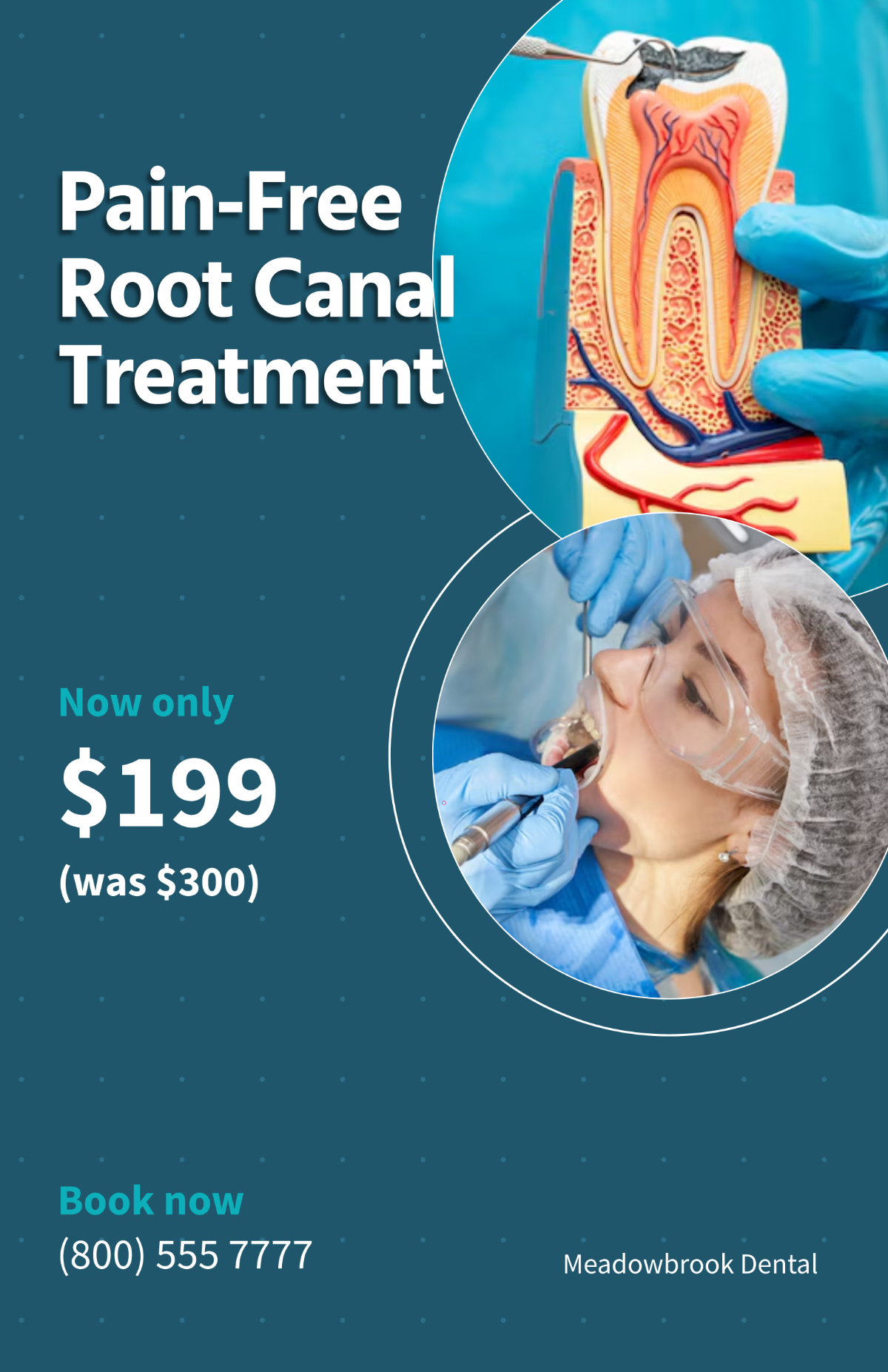 Free Dental Root Canal Poster Template