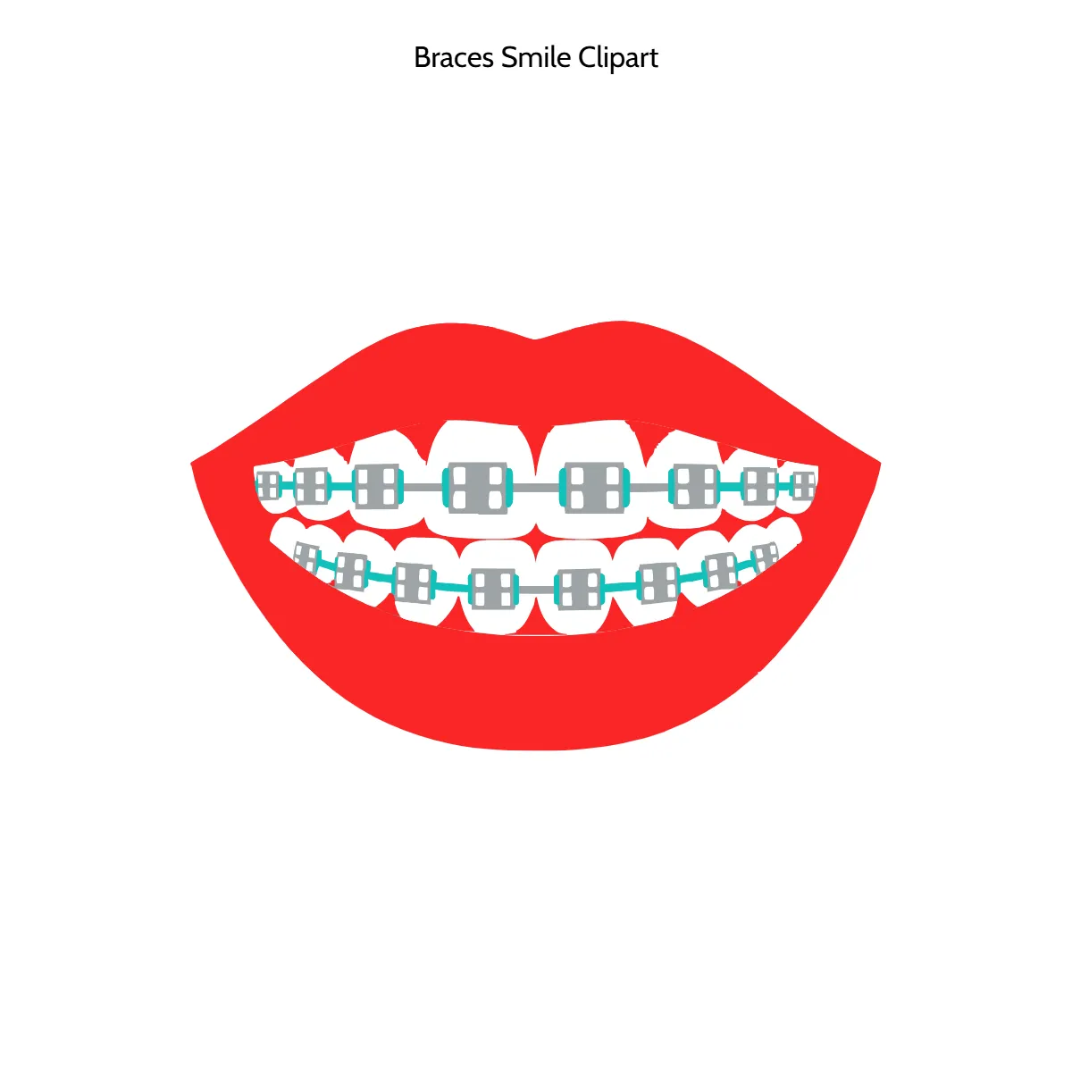 Free Braces Smile Vector Clipart (PNG, SVG) to Edit Online