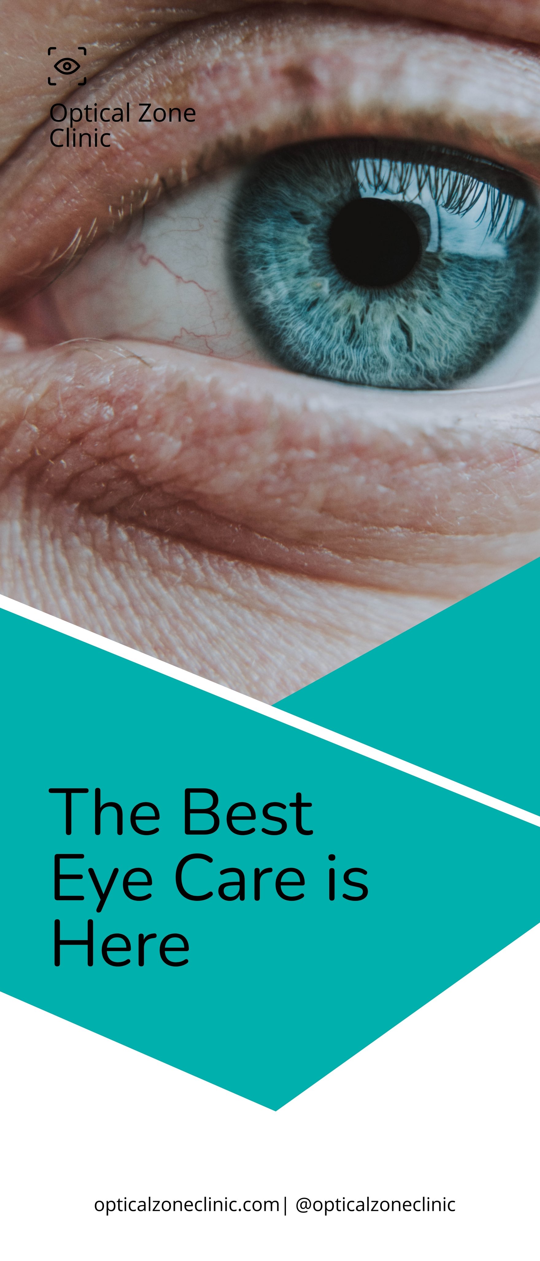 Eye Clinic Roll Up Banner Template