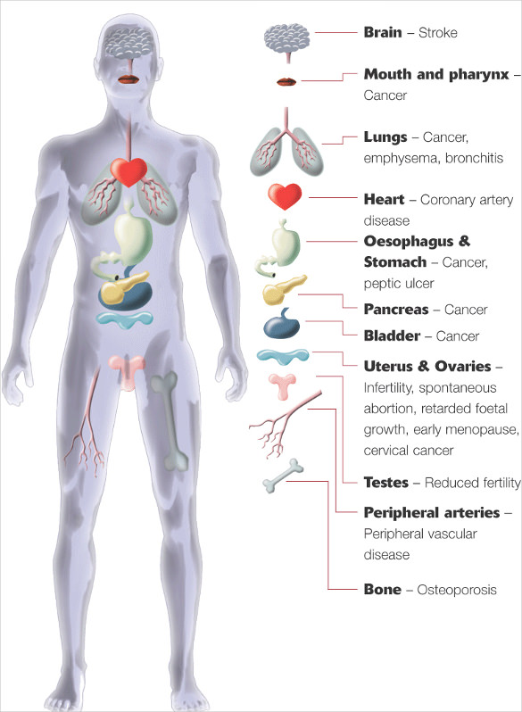 9+ Free Body Diagram - Free Printable Download | Free ...