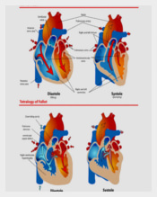 Anatomical-Heart-Diagram-of-Blue-Baby