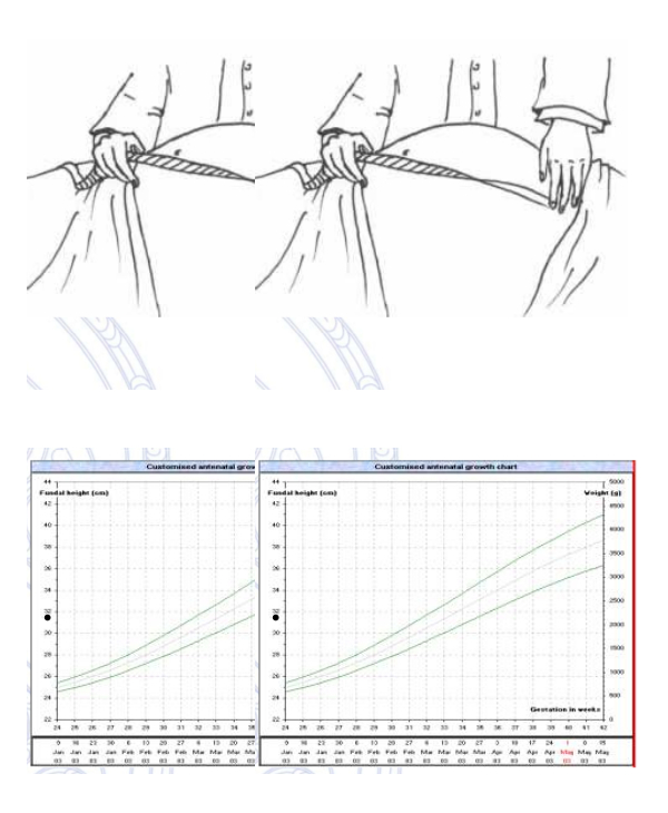 7+ Unborn Baby Growth Chart Templates Free Sample, Example, Format